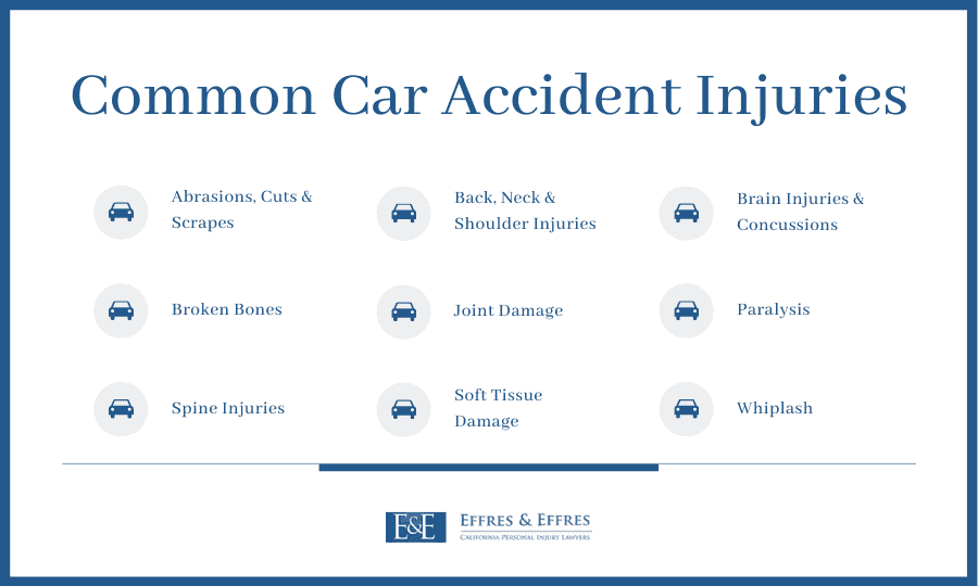 Common Car Accident Injuries Infographic